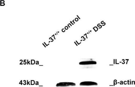 Fig.2.B showing Western Blotting in a Mus musculus (House mouse) sample from the publication: Anti-Inflammatory Effect of IL-37-Producing T-Cell Population in DSS-Induced Chronic Inflammatory Bowel Disease in Mice.