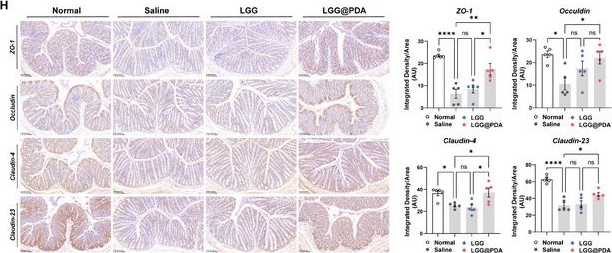 Fig.4.H showing Immunohistochemistry from the publication: Polydopamine-Encapsulated Probiotics Restore Gut Homeostasis and Reinstate Macrophage Efferocytosis in Systemic Lupus Erythematosus.
