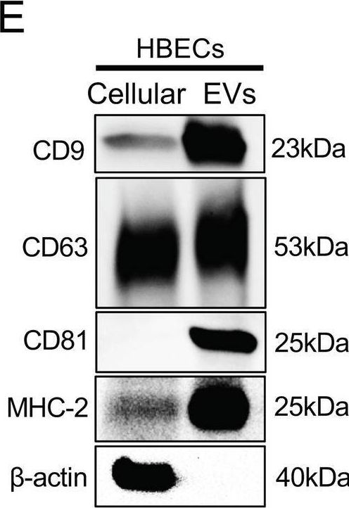 Fig.1.E showing Western Blotting from the publication: Mitigation of acute lung injury by human bronchial epithelial cell-derived extracellular vesicles via ANXA1-mediated FPR signaling.
