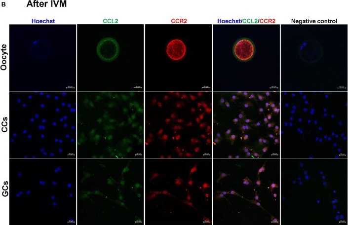 Fig.2.B showing Immunocytochemistry-immunofluorescence from the publication: The effect of C-C motif chemokine ligand 2 supplementation on in vitro maturation of porcine cumulus-oocyte complexes and subsequent developmental competence after parthenogenetic activation.