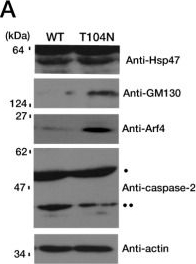 Fig.4.A showing Western Blotting in a Mus musculus (House mouse) sample from the publication: FTD/ALS Type 7-Associated Thr104Asn Mutation of CHMP2B Blunts Neuronal Process Elongation, and Is Recovered by Knockdown of Arf4, the Golgi Stress Regulator.