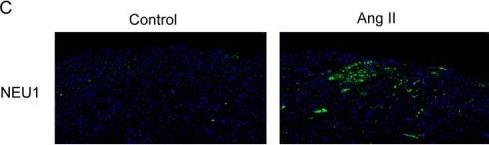 Fig.1.C showing Immunohistochemistry-immunofluorescence in a Mus musculus (House mouse) sample from the publication: N6-methyladenosine modification of NEU1 mediated by METTL3 exacerbates angiotensin II-induced atrial fibrillation.