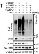 Fig.4.T showing Western Blotting from the publication: CSN6 Promotes Pancreatic Cancer Progression and Gemcitabine Resistance via Antagonizing DCAF1-Mediated Ubiquitination of NPM1.