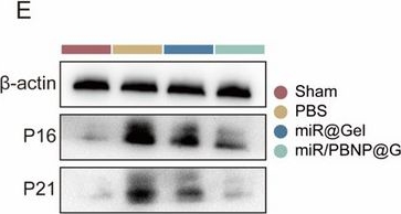 Fig.8.E showing Western Blotting from the publication: Nanozyme-Reinforced miR-197-3p Delivery Resets Metabolic and Senescence Pathways to Rejuvenate Osteoarthritic Cartilage.