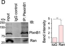 Fig.6.D showing Western Blotting in a Homo sapiens (Human) sample from the publication: B-type Plexins promote the GTPase activity of Ran to affect androgen receptor nuclear translocation in prostate cancer.