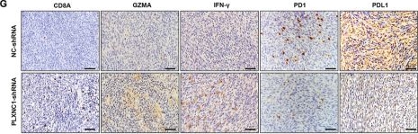 Fig.9.G showing Immunohistochemistry from the publication: Identification of PLXNC1 as a novel biomarker for consensus molecular subtype 4 in colorectal cancer.