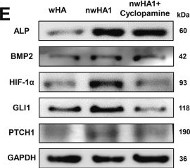 Fig.3.E showing Western Blotting in a Homo sapiens (Human) sample from the publication: Hierarchical micro-/nanostructured hydroxyapatite scaffolds promote osteoporotic bone regeneration via activation of hedgehog and HIF-1α signaling.