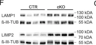 Fig.3.F showing Western Blotting in a Mus musculus (House mouse) sample from the publication: Peroxisomal dysfunctions cause lysosomal storage and axonal Kv1 channel redistribution in peripheral neuropathy.