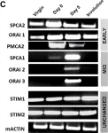 Fig.1.C showing Western Blotting in a Mus musculus (House mouse) sample from the publication: SPCA2 regulates Orai1 trafficking and store independent Ca2+ entry in a model of lactation.
