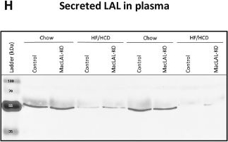 Fig.6.H showing Western Blotting in a Mus musculus (House mouse) sample from the publication: Secreted enzyme uptake masks the in vivo phenotype of macrophage-specific lysosomal acid lipase deletion.