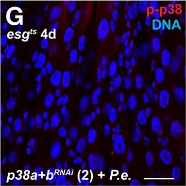 Fig.3.G showing Immunocytochemistry-immunofluorescence from the publication: Recognition of pathogenic bacteria by intestinal stem cells promotes adult Drosophila midgut regeneration.