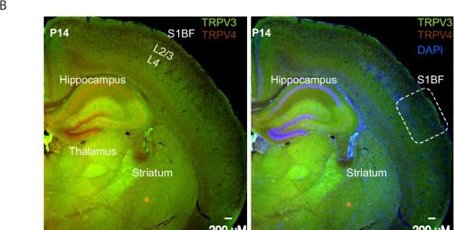 Fig.7.B showing Immunohistochemistry-immunofluorescence from the publication: TRPV3 channel activity helps cortical neurons stay active during fever.