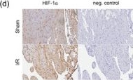 Fig.2.D showing Immunohistochemistry in a Mus musculus (House mouse) sample from the publication: Cardioprotective effects of prolyl hydroxylase inhibitors during reperfusion in myocardial infarction: A study using cardiosphere-derived cells.