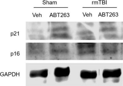 Fig.7.B showing Western Blotting in a Mus musculus (House mouse) sample from the publication: Neurons and glial cells acquire a senescent signature after repeated mild traumatic brain injury in a sex-dependent manner.