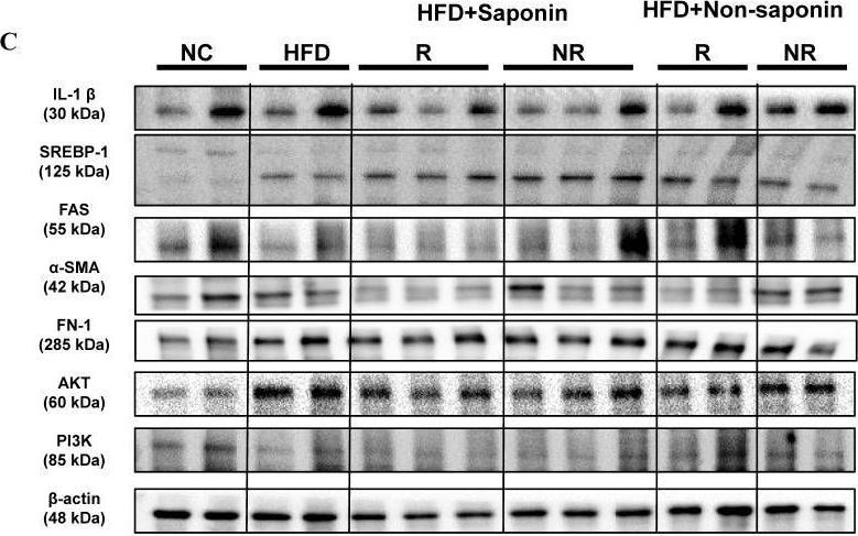 Fig.3.C showing Western Blotting from the publication: Biomarker-Driven Optimization of Saponin Therapy in MASLD: From Mouse Models to Human Liver Organoids.