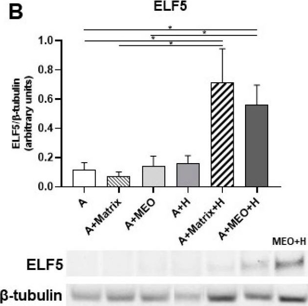 Fig.6.B showing Western Blotting in a Mus musculus (House mouse) sample from the publication: Adipo-Epithelial Transdifferentiation in In Vitro Models of the Mammary Gland.
