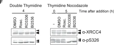 Fig.4.F showing Western Blotting in a Homo sapiens (Human) sample from the publication: Canonical non-homologous end joining in mitosis induces genome instability and is suppressed by M-phase-specific phosphorylation of XRCC4.