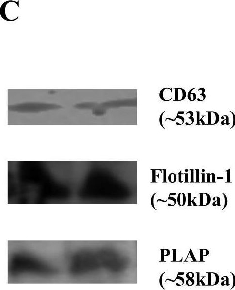 Fig.2.C showing Western Blotting in a Homo sapiens (Human) sample from the publication: EV-microRNA signatures in pregnant women with idiopathic recurrent pregnancy loss: deciphering microRNAome pathway networks at feto-maternal interface.