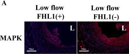 Fig.5.A showing Immunohistochemistry-immunofluorescence in a Rattus norvegicus (Rat) sample from the publication: Four and a half Lin11, Isl-1, Mec-3(LIM) domain protein 1 (FHL1) regulates vascular remodeling in low-flow vein grafts.