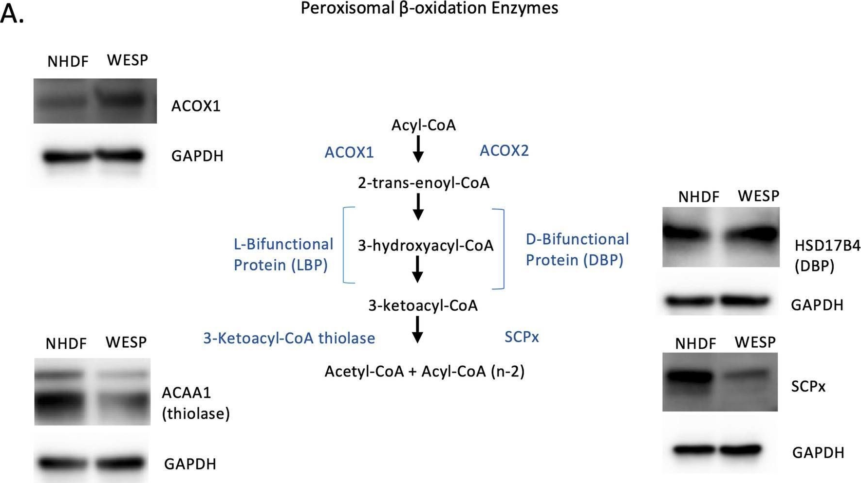 Fig.3.A showing Western Blotting from the publication: SCP2 variant is associated with alterations in lipid metabolism, brainstem neurodegeneration, and testicular defects.