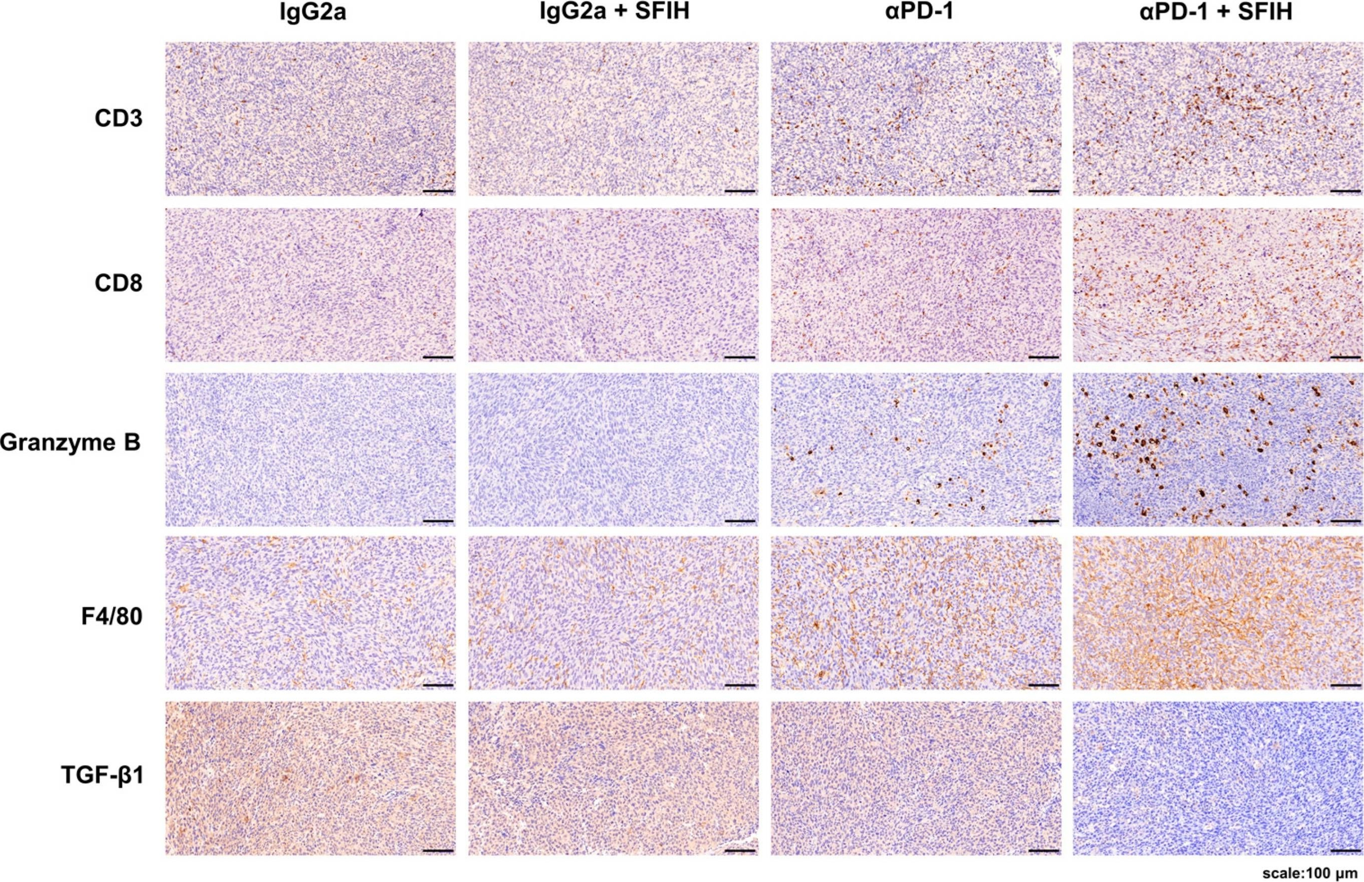 Fig.4.A showing Immunohistochemistry-paraffin in a Mus musculus (House mouse) sample from the publication: The Sesquiterpene Lactone-Rich Fraction of Inula helenium L. Enhances the Antitumor Effect of Anti-PD-1 Antibody in Colorectal Cancer: Integrative Phytochemical, Transcriptomic, and Experimental Analyses.