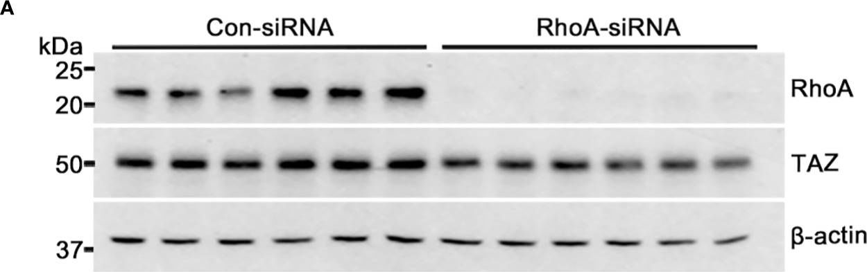 Fig.6.A showing Western Blotting in a Homo sapiens (Human) sample from the publication: TAZ is involved in breast cancer cell migration via regulating actin dynamics.
