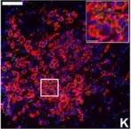 Fig.7.K showing Immunocytochemistry-immunofluorescence in a Mus musculus (House mouse) sample from the publication: IFN-gamma signaling in the central nervous system controls the course of experimental autoimmune encephalomyelitis independently of the localization and composition of inflammatory foci.