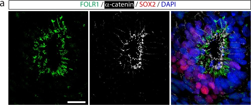 Fig.1.A showing Immunohistochemistry-immunofluorescence in a Homo sapiens (Human) sample from the publication: Noncanonical function of folate through folate receptor 1 during neural tube formation.