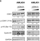 Fig.6.C showing Western Blotting from the publication: STK3 is a therapeutic target for a subset of acute myeloid leukemias.