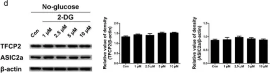 Fig.3.D showing Western Blotting from the publication: Glucose Deficiency Elevates Acid-Sensing Ion Channel 2a Expression and Increases Seizure Susceptibility in Temporal Lobe Epilepsy.