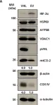 Fig.1.A showing Western Blotting from the publication: VHL-Mediated Regulation of CHCHD4 and Mitochondrial Function.