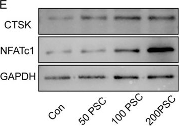 Fig.1.E showing Western Blotting from the publication: Echinococcus granulosus sensu lato promotes osteoclast differentiation through DUSP4-MAPK signaling in osseous echinococcosis.