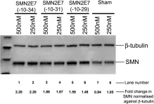 Fig.6.A showing Western Blotting in a Mus musculus (House mouse) sample from the publication: Improved antisense oligonucleotide design to suppress aberrant SMN2 gene transcript processing: towards a treatment for spinal muscular atrophy.