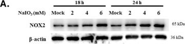 Fig.2.A showing Western Blotting in a Homo sapiens (Human) sample from the publication: Tetrahydrocurcumin Attenuates NaIO3-Induced Retinal Oxidative Injury via Suppression of NOX2-Derived ROS-Mediated Apoptosis.
