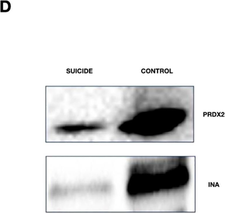 Fig.2.D showing Western Blotting in a Homo sapiens (Human) sample from the publication: Proteome analysis of the prefrontal cortex and the application of machine learning models for the identification of potential biomarkers related to suicide.