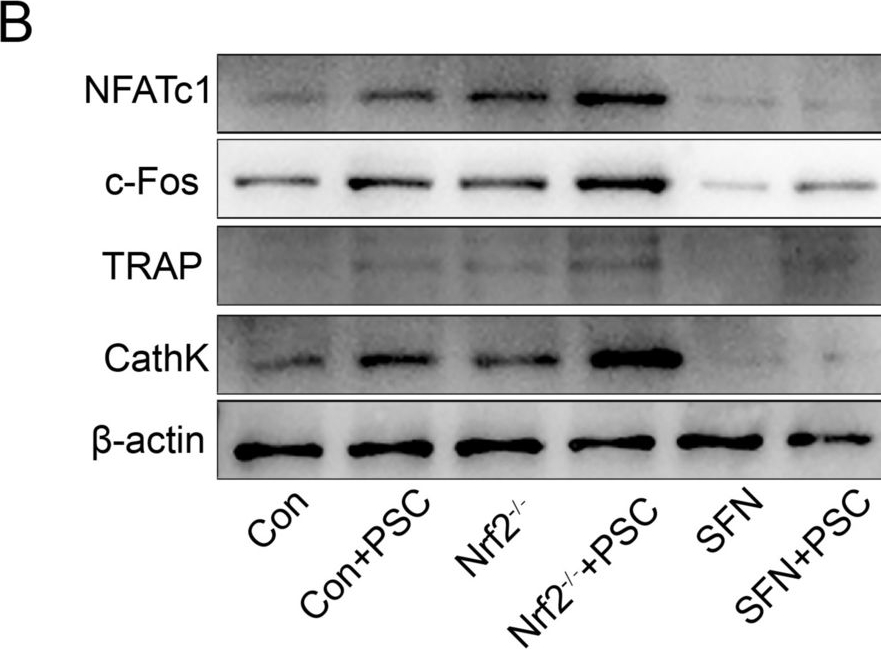 Fig.4.B showing Western Blotting in a Mus musculus (House mouse) sample from the publication: Echinococcus granulosus promotes MAPK pathway-mediated osteoclast differentiation by inhibiting Nrf2 in osseous echinococcosis.