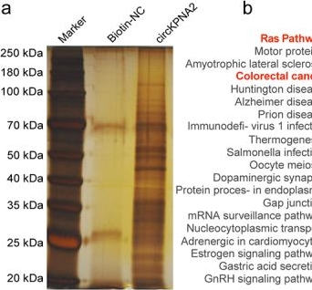 Fig.3.A showing Western Blotting from the publication: m6A methylation of circKPNA2 promotes colorectal carcinogenesis by activating the RIN1-Ras pathway.