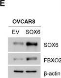 Fig.2.E showing Western Blotting in a Homo sapiens (Human) sample from the publication: FBXO2 targets glycosylated SUN2 for ubiquitination and degradation to promote ovarian cancer development.
