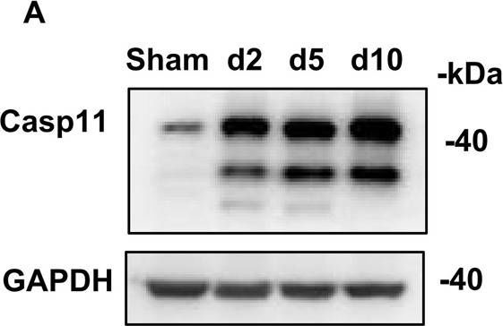 Fig.8.A showing Western Blotting in a Mus musculus (House mouse) sample from the publication: GSDMD-dependent neutrophil extracellular traps promote macrophage-to-myofibroblast transition and renal fibrosis in obstructive nephropathy.