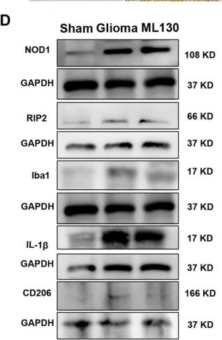 Fig.5.D showing Western Blotting in a Rattus norvegicus (Rat) sample from the publication: NOD1/RIP2 Pathway Promotes Glioma Progression Through Microglial M2 Polarization.