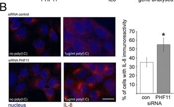 Fig.7.B showing Immunocytochemistry-immunofluorescence from the publication: PHF11 expression and cellular distribution is regulated by the Toll-Like Receptor 3 Ligand Polyinosinic:Polycytidylic Acid in HaCaT keratinocytes.