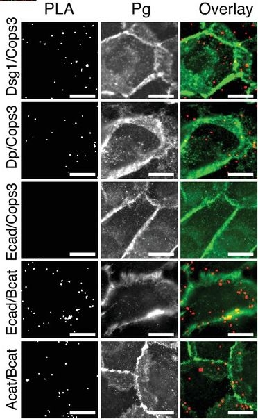 Epidermal Growth Factor Receptor neddylation is regulated by a desmosomal-COP9 (Constitutive Photomorphogenesis 9) signalosome complex.