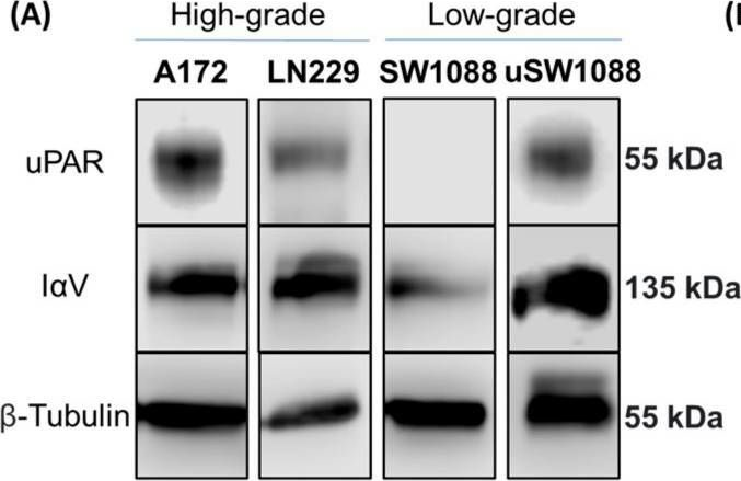 Fig.1.A showing Western Blotting from the publication: N-Glycosylation as a Key Requirement for the Positive Interaction of Integrin and uPAR in Glioblastoma.
