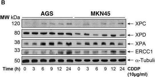 Fig.4.B showing Western Blotting in a Homo sapiens (Human) sample from the publication: XPA, XPC, and XPD Modulate Sensitivity in Gastric Cisplatin Resistance Cancer Cells.