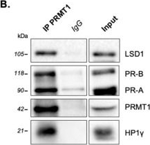 Fig.1.B showing Western Blotting in a Homo sapiens (Human) sample from the publication: PRMT1, a Key Modulator of Unliganded Progesterone Receptor Signaling in Breast Cancer.