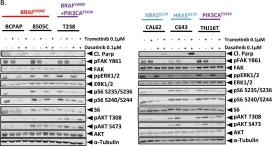 Fig.2.B showing Western Blotting in a Homo sapiens (Human) sample from the publication: Src-mediated regulation of the PI3K pathway in advanced papillary and anaplastic thyroid cancer.