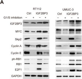 Fig.2.A showing Western Blotting from the publication: MKRN2-Mediated Degradation of IGF2BP3 Suppresses MYC and Enhances CDK4/6 Inhibitor Sensitivity in Bladder Cancer.