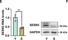 Fig.7.E showing Western Blotting from the publication: Super-enhancer-driven core transcription factor FOXP1 delays endothelial cell senescence via phase separation-mediated SESN3 activation.