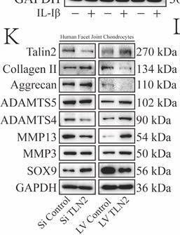 Fig.1.K showing Western Blotting in a Homo sapiens (Human) sample from the publication: Mechanical Load-Induced Upregulation of Talin2 through Non-Canonical Deubiquitination of OTUB1 Drives Facet Joint Osteoarthritis Pathogenesis.