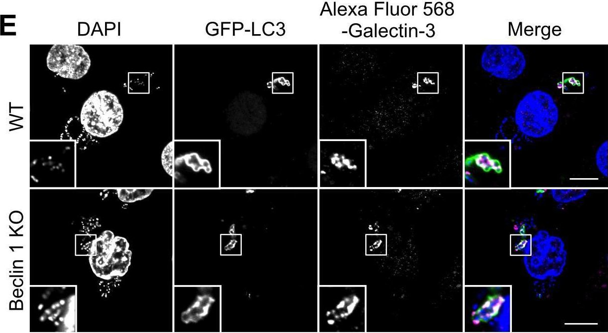 Fig.3.E showing Immunocytochemistry-immunofluorescence from the publication: Bcl-xL Affects Group A Streptococcus-Induced Autophagy Directly, by Inhibiting Fusion between Autophagosomes and Lysosomes, and Indirectly, by Inhibiting Bacterial Internalization via Interaction with Beclin 1-UVRAG.